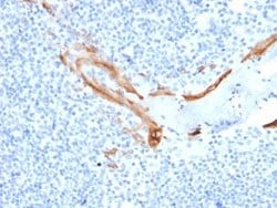 Cytokeratin 16 Antibody (SPM264) - Azide and BSA Free, Novus Biologicals 100 &mu;g | Buy Online | Novus Biologicals | Fisher Scientific